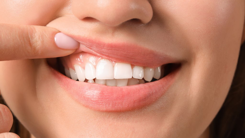 What to do about receding gums